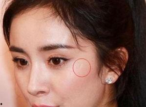 哪些明星脸上有胎记,揭秘拥有独特胎记的明星风采