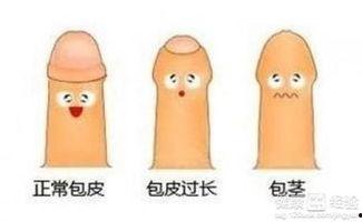 男明星做包皮,包皮那些事儿